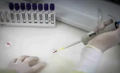 Paciente em SP com suspeita de ebola testa positivo para meningite